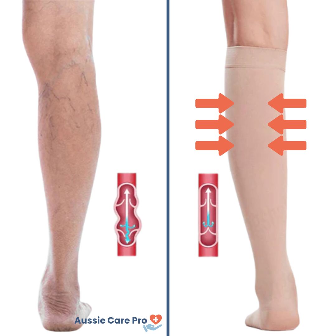 Graduated Compression Socks – Open-Toe Support for Better Blood Circulation