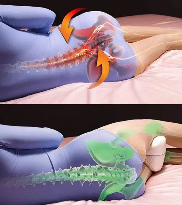 Orthopedic Knee and Leg Pillow